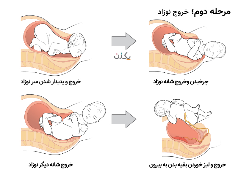 مراحل زایمان طبیعی به صورت تصویری